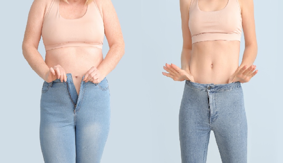 Understanding the Benefits of Cryolipolysis for Weight Loss